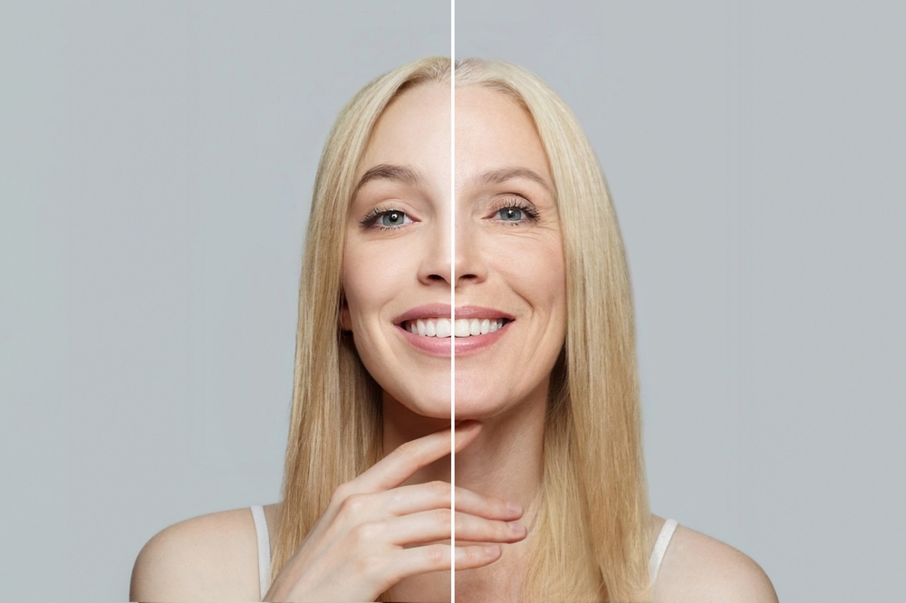 Bush Wrinkle What to Expect Before, During & After Wrinkle Treatment